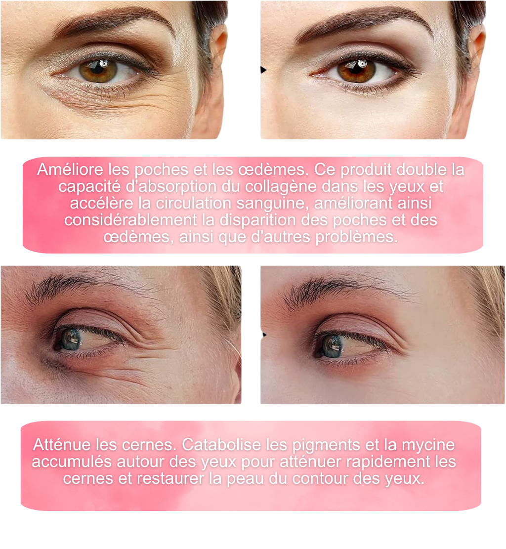 Patchs au collagène anti cernes + Masque facial minceur double menton